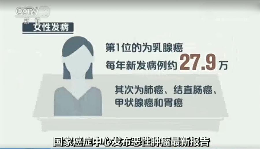 千门女王之黄雀在后